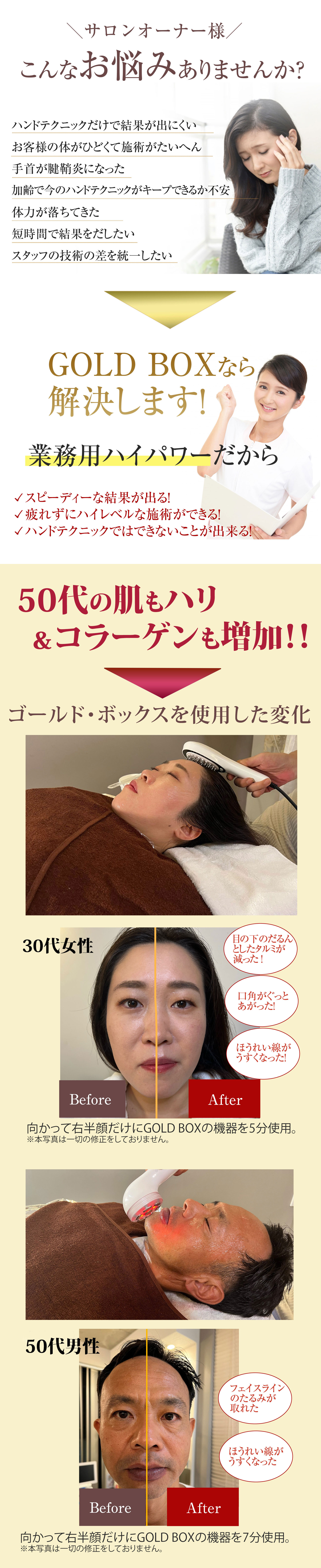 ゴールドボックスなら悩み解消！